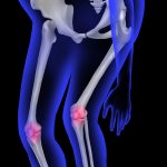 joints pain
